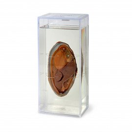 Набір вологих препаратів і біопластів